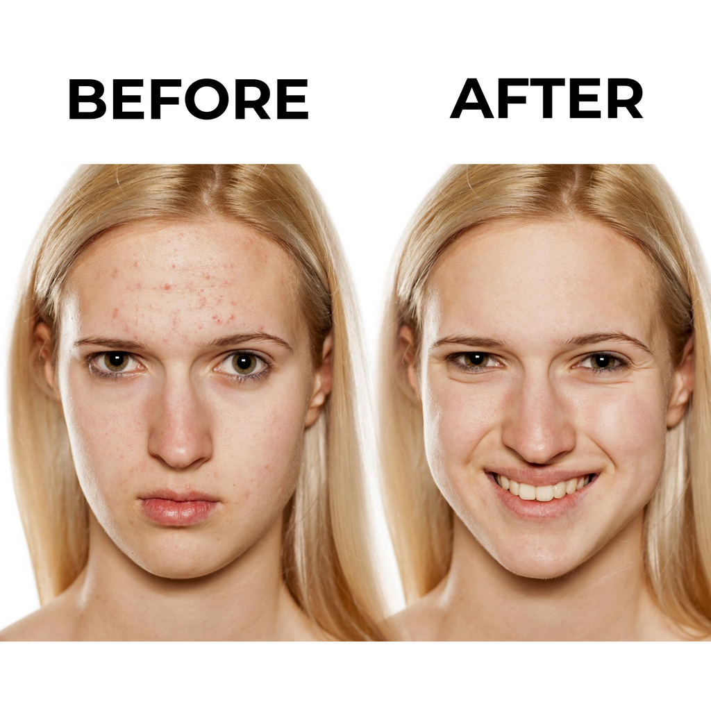 Aloe Vera Gel - 100ml-MyGlitterBox